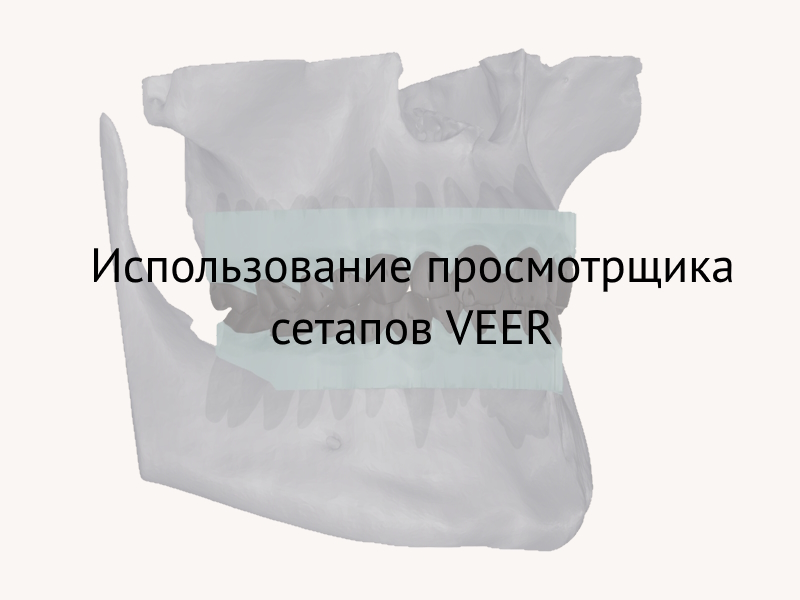 Блок 10 - Использование вьюера VEER